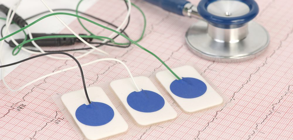 Proposed Heart Rate Detection Method May Predict Epileptic Seizures