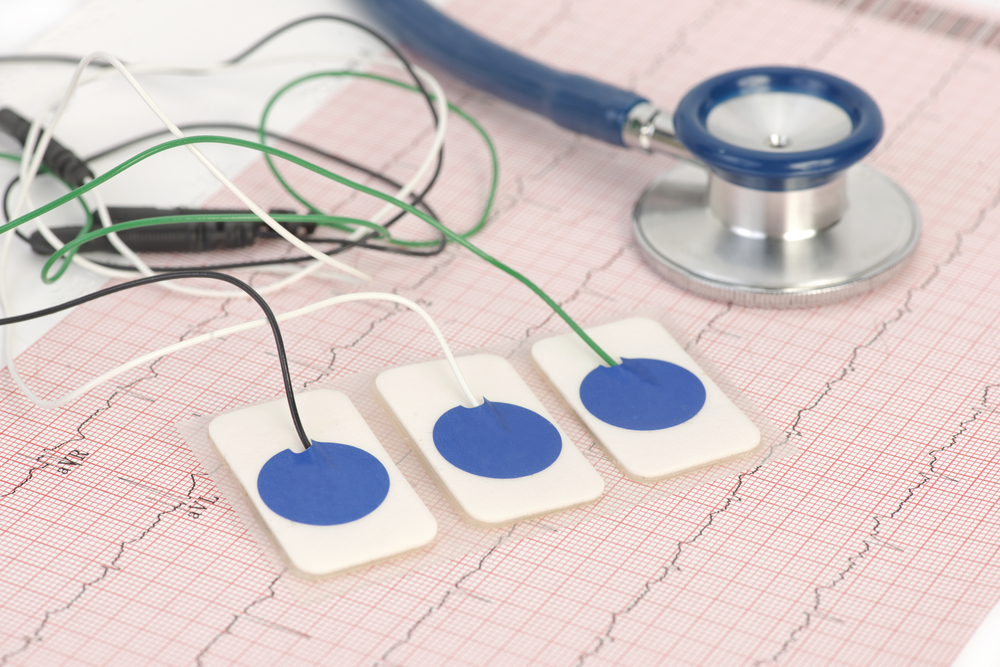 Proposed Heart Rate Detection Method May Predict Epileptic Seizures Epilepsy News Today