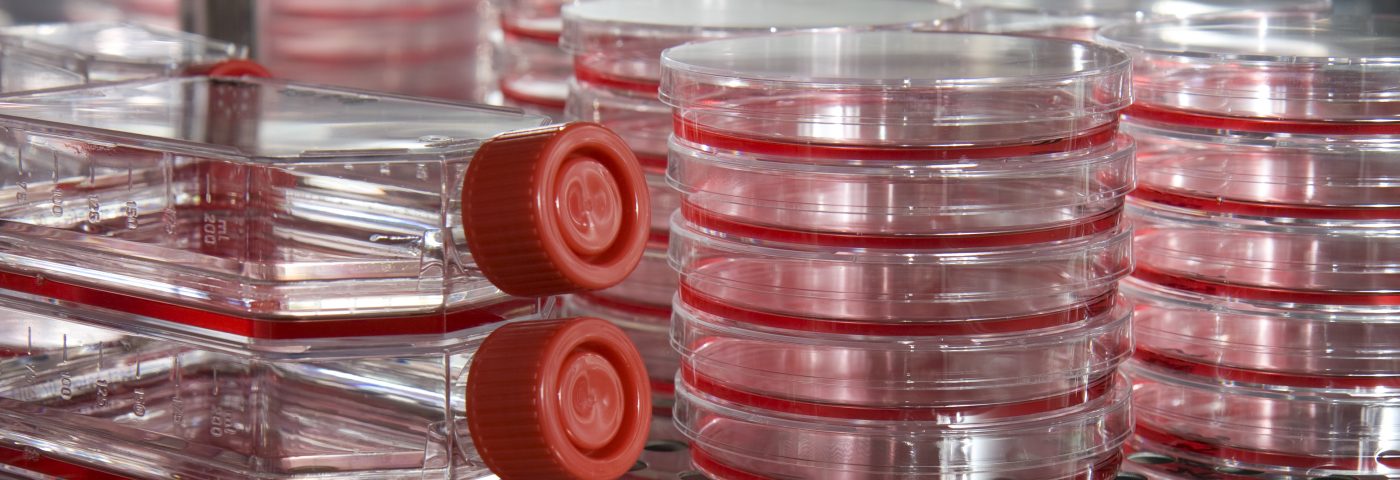 Epilepsy Researchers Make Strides with New Method of Mass-producing GABA Neurons